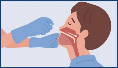 Test Covid nasopharyngés et sanguins